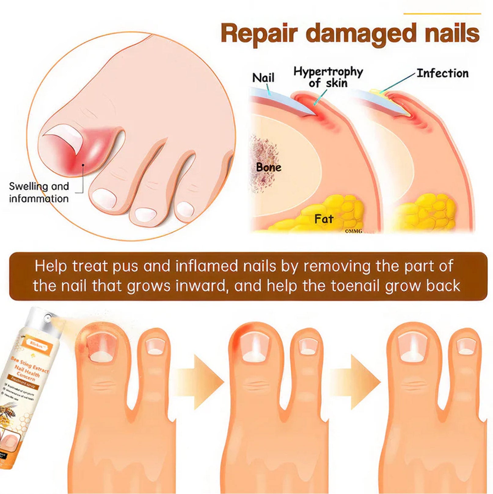 Rosegy Bee Sting  Extract Nail Care Spray –Moisturizing & Brightening Formula