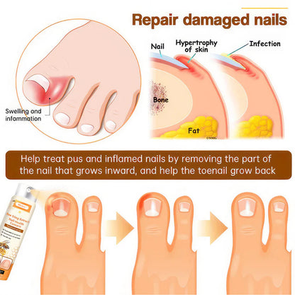 Rosegy Bee Sting  Extract Nail Care Spray –Moisturizing & Brightening Formula