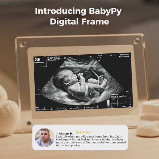 BabyPy First Capture Digital Frame (Live Ultrasound Digital Frame)