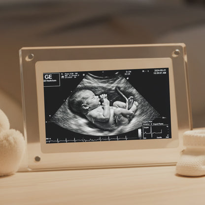 BabyPy First Capture Digital Frame (Live Ultrasound Digital Frame)