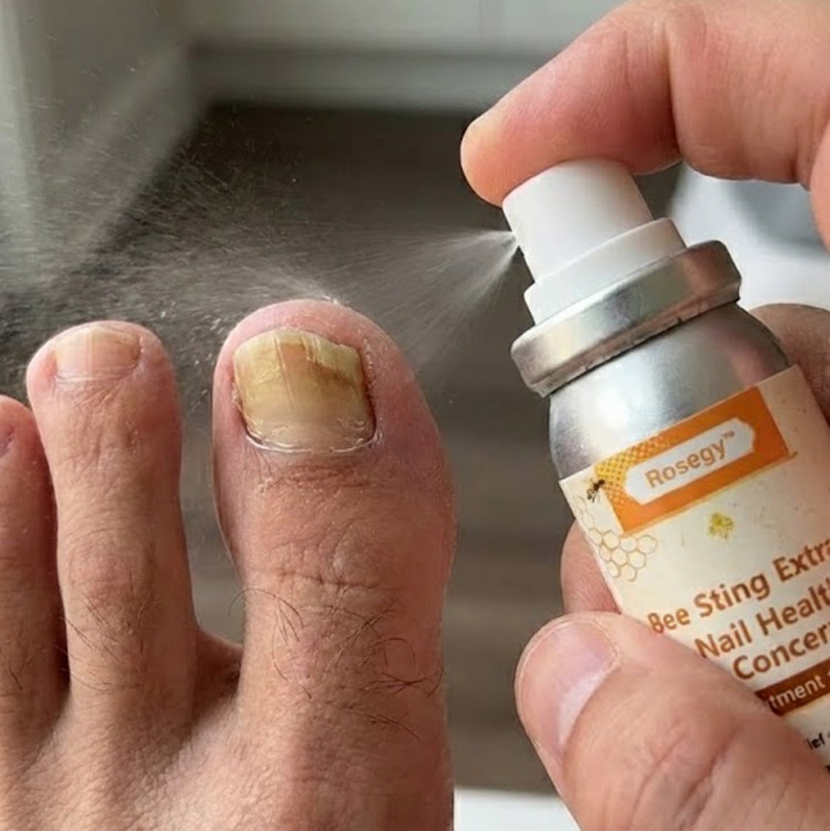 Rosegy Bee Sting  Extract Nail Care Spray –Moisturizing & Brightening Formula